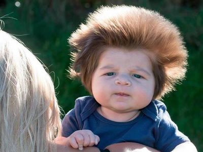 Foto: 10 Bayi yang Terlahir dengan Rambut Unik, Gemas!