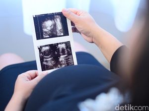 Just for Fun! Nama-nama Ibu yang Diprediksi Hamil di 2018