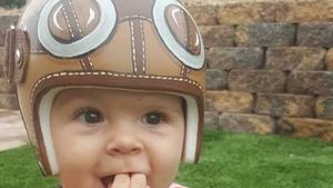 Foto Imutnya Para Bayi Pakai Helm Karena Bentuk Kepala Tak Rata