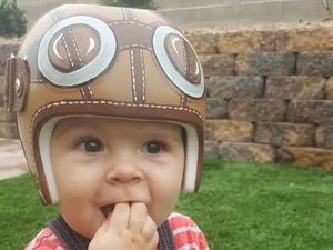Foto Imutnya Para Bayi Pakai Helm Karena Bentuk Kepala Tak Rata Foto Imutnya Para Bayi Pakai Helm Karena Bentuk Kepala Tak Rata