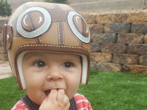 Foto Imutnya Para Bayi Pakai Helm Karena Bentuk Kepala Tak Rata