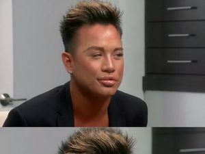 Tren Pria Suntik Filler di Bibir untuk Tampilan Mulut yang Lebih Macho