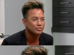 Tren Pria Suntik Filler di Bibir untuk Tampilan Mulut yang Lebih Macho