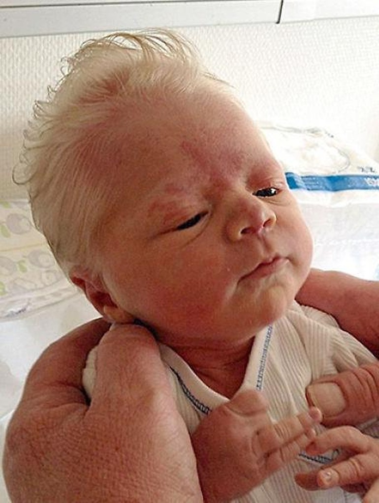 Foto 10 Bayi Yang Terlahir Dengan Rambut Unik