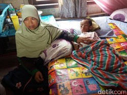 Tolong, Bocah di Banjarnegara Ini Terkulai Lemah karena Tumor Otak