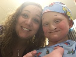 Bukan Hanya di Bibir, Bocah Ini Alami Sumbing di Hampir Sekujur Tubuhnya