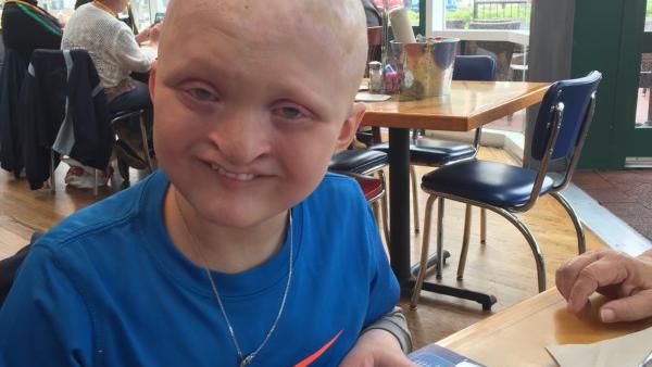 Ini Dia Bocah asal AS dengan Sumbing di Hampir Sekujur Tubuh