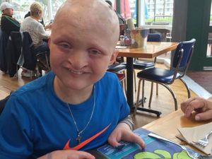 Ini Dia Bocah asal AS dengan Sumbing di Hampir Sekujur Tubuh