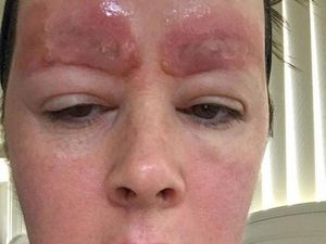 Ingin Alis Sempurna, Wanita Ini Malah Alami Hal Mengerikan Ingin Alis Sempurna, Wanita Ini Malah Alami Hal Mengerikan