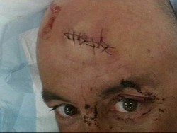 Paus Bongkok Balikkan Kapal Yacht, Penumpang Terluka