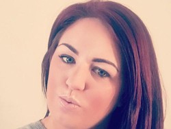 Mengerikan! Coba-coba Cat Rambut Sendiri di Rumah, Wanita Ini Malah Botak