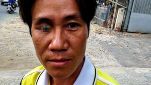 Potret Selfie Iseng Para Pengguna Mata Palsu