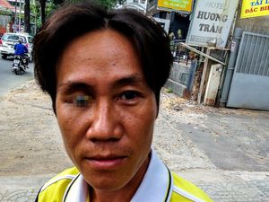 Potret Selfie Iseng Para Pengguna Mata Palsu