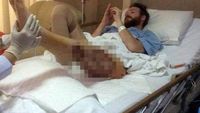 Potret Mereka yang Bertahan Hidup Pasca Infeksi Bakteri Pemakan Daging