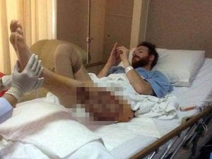 Potret Mereka yang Bertahan Hidup Pasca Infeksi Bakteri Pemakan Daging