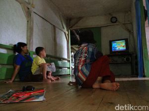 Derita Ramdan, Bocah 11 Tahun di Bandung Idap Tumor Ganas di Kepala