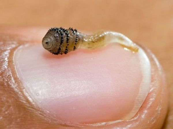 Potret Belatung Parasit di Tubuh Ini Bikin Merinding!