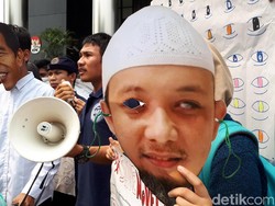 Novel Jalani Operasi Kedua Mata Kiri Bulan Depan