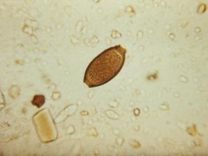 Telur Cacing Parasit Ini Dijual Sebagai Makanan, Berani Coba?