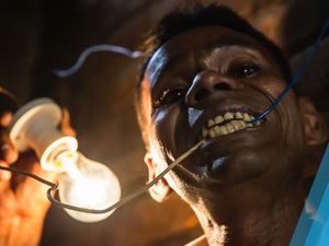 Video: Pria Ini Dijuluki Manusia Bohlam, Kenapa?