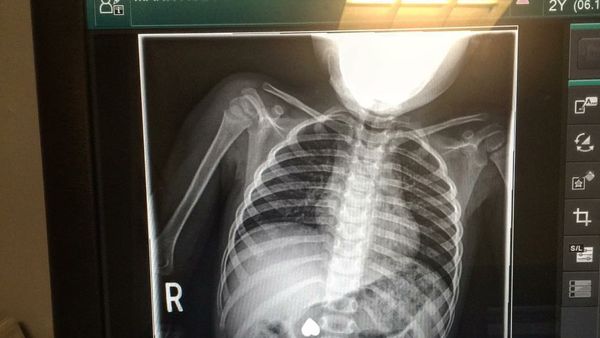 8 Foto Rontgen Unik yang Bisa Bikin Ketawa