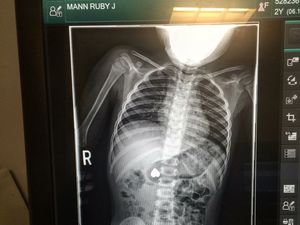 8 Foto Rontgen Unik yang Bisa Bikin Ketawa