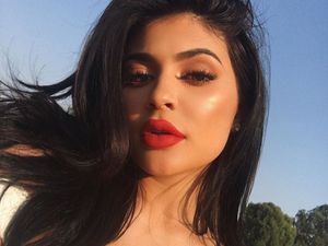 Tren di Indonesia: Suntik Bibir Jadi Seksi Seperti Kylie Jenner