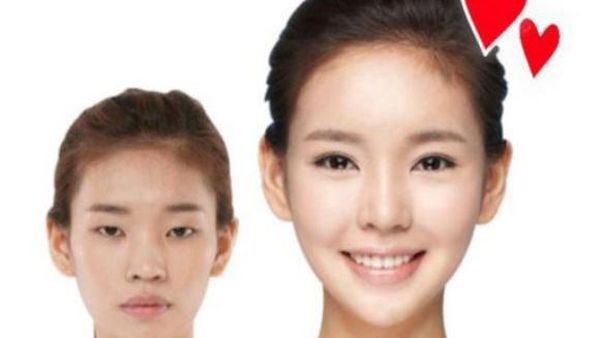 Perubahan 15 Cewek Korea Sebelum & Sesudah Operasi Plastik, Bikin Syok!