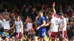 Kala Chelsea Dipermalukan Burnley