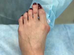 Ouch!! Foto-foto Ini Buktikan High Heels Tidak Baik untuk Kesehatan Kaki