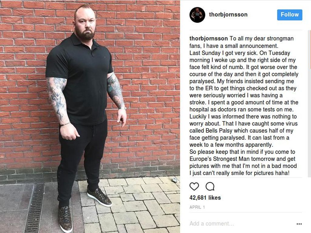 Waduh! The Mountain GOT Ternyata Pernah Kena Bells Palsy Waduh! The Mountain GOT Ternyata Pernah Kena Bells Palsy