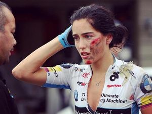 Wajah Penuh Luka Namun Tetap Cantik? Cuma Wanita Ini yang Bisa