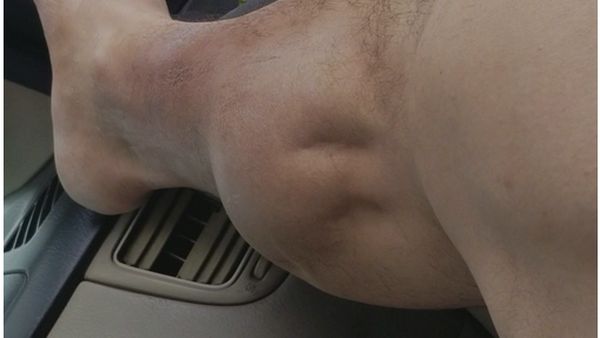 Ngeri!! Otot Kaki Pria Ini Kram Seperti Kemasukan Mahluk Hidup