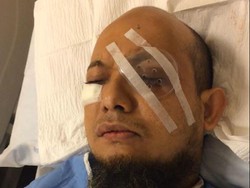 Kornea Tertutup 100 Persen, Kondisi Mata Kanan Novel Membaik