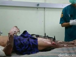 Tersengat Listrik, Tukang Bangunan di Purworejo Luka Bakar Parah