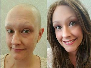 Transformasi Para Penyintas Kanker, Dari Botak dan Pucat Kembali Cantik