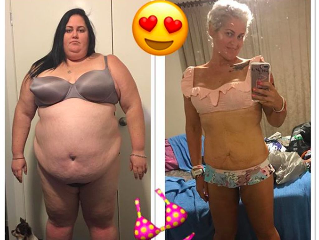 Foto: Diprediksi Tak Berumur Panjang Jadi Motivasi Turunkan Bobot 115 kg Foto: Diprediksi Tak Berumur Panjang Jadi Motivasi Turunkan Bobot 115 kg