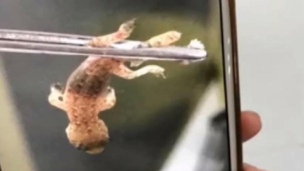 Potret Operasi Pengangkatan Cicak Hidup dari Telinga Pria asal China Potret Operasi Pengangkatan Cicak Hidup dari Telinga Pria asal China