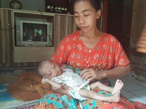 Ibu di Serang Tak Mampu Biayai Berobat Anaknya Ibu di Serang Tak Mampu Biayai Berobat Anaknya