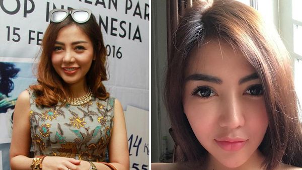 Foto: 9 Perubahan Wajah Artis Cantik yang Dulu Tembem Sekarang Tirus