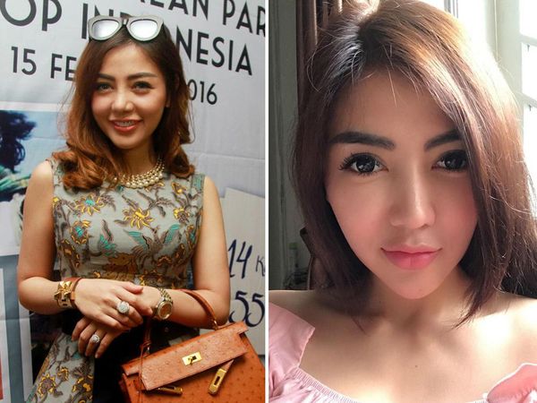 Foto: 9 Perubahan Wajah Artis Cantik yang Dulu Tembem Sekarang Tirus