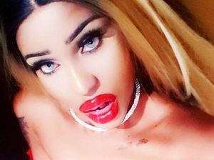 Diselingkuhi Tunangan, Wanita Ini Rogoh Rp 171 Juta Oplas Mirip Boneka Seks