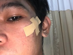 Mencoba Mengingatkan, Pria ini Justru Dianiaya Tetangga Sendiri