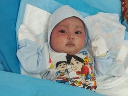 Derita Penyakit Langka, Bayi di Pekanbaru Ini Butuh Uluran Tangan