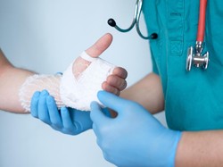 Cerita Dokter Ganti Ibu Jari Tangan Korban Kecelakaan Pakai Jempol Kaki