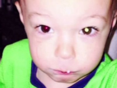 5 Penyakit Berbahaya yang Bisa Terdeteksi Lewat Selfie