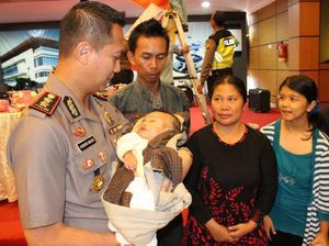Akhirnya Nuraini Operasi Bibir Sumbing, Terima Kasih Pak Polisi Akhirnya Nuraini Operasi Bibir Sumbing, Terima Kasih Pak Polisi