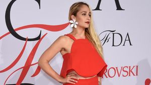 Foto: 7 Selebriti Pamer Bulu Ketiak di Karpet Merah