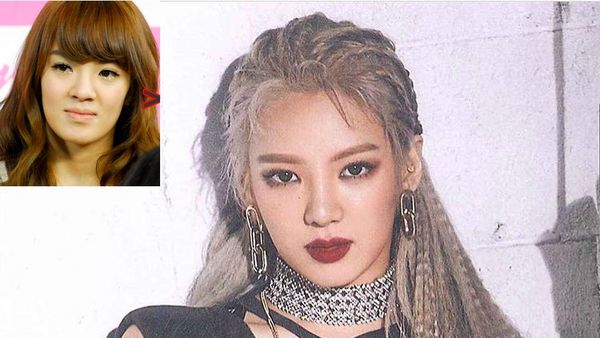 Foto Mengejutkan 8 Artis Korea Sebelum dan Sesudah Operasi Plastik