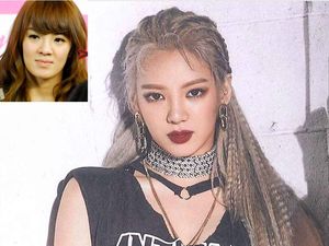 Foto Mengejutkan 8 Artis Korea Sebelum dan Sesudah Operasi Plastik